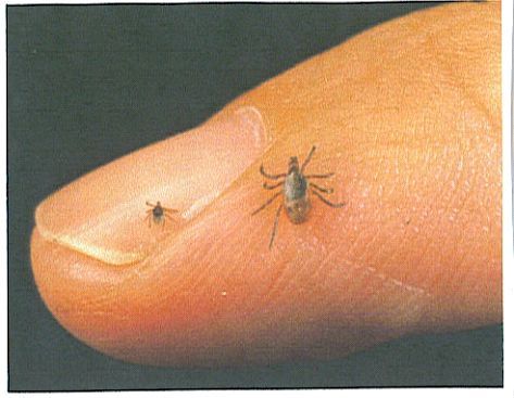 Deer Tick on Finger